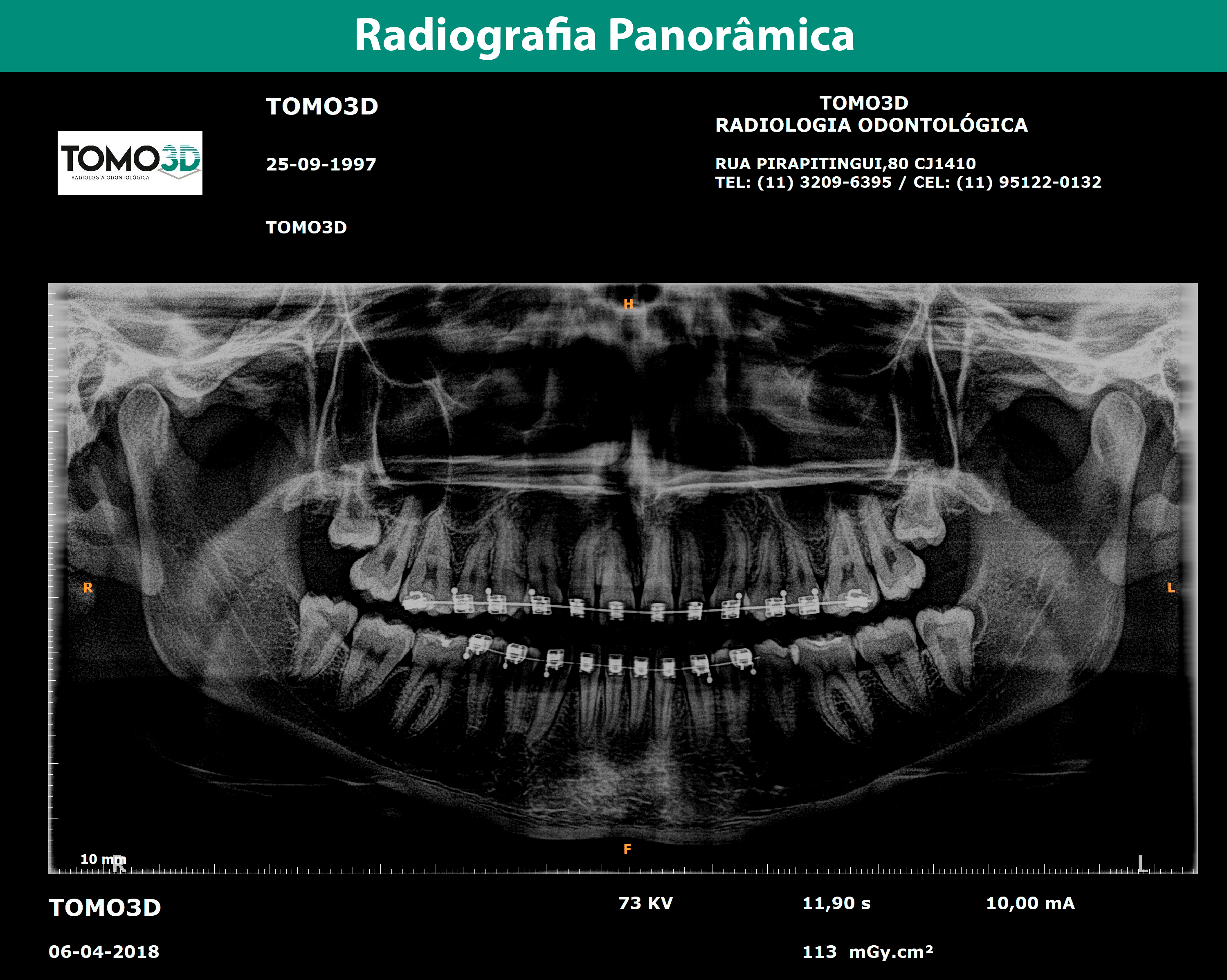 tomo 3d radiologia odontologica em sp